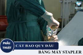 Phẫu thuật cắt bao quy đầu tại Đà Nẵng bằng máy STAPLER chỉ với 10 phút