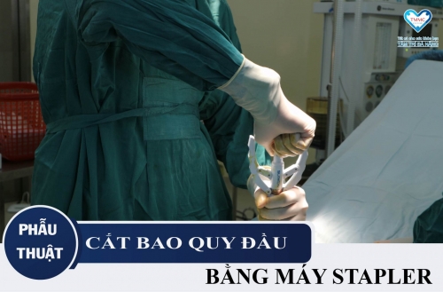 Phẫu thuật cắt bao quy đầu tại Đà Nẵng bằng máy STAPLER chỉ với 10 phút