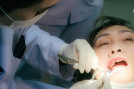 Nhổ răng không đau nên chọn gây tê hay gây mê?